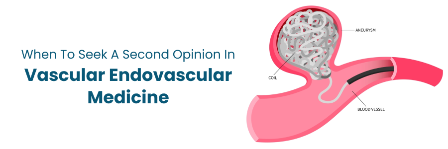 Second Opinion for Vascular Endovascular Diagnosis