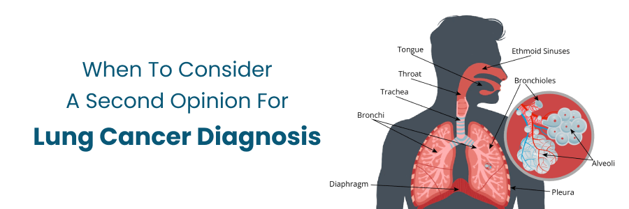 Second Opinion for Lung Cancer Diagnosis