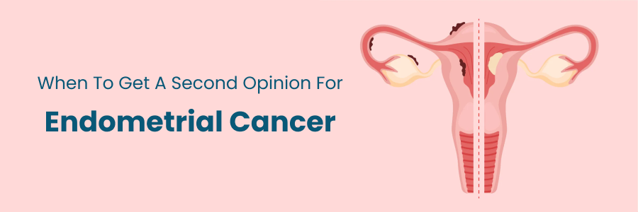 When to Get a Second Opinion for Endometrial Cancer