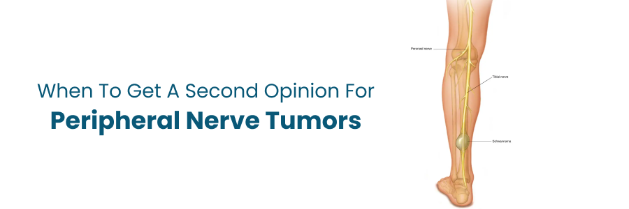 When to Get a Second Opinion for Peripheral Nerve Tumors
