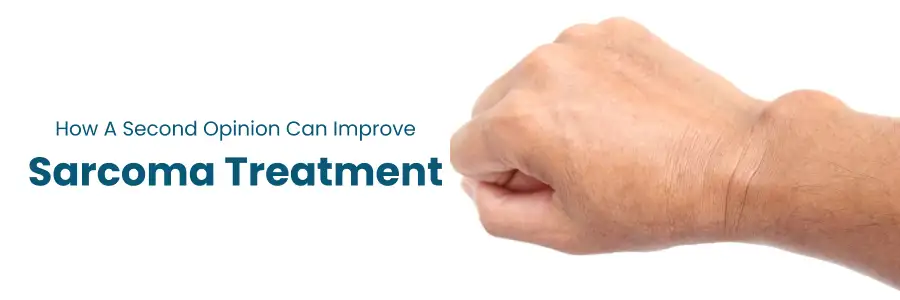 When to Get a Second Opinion on Sarcoma Cancer