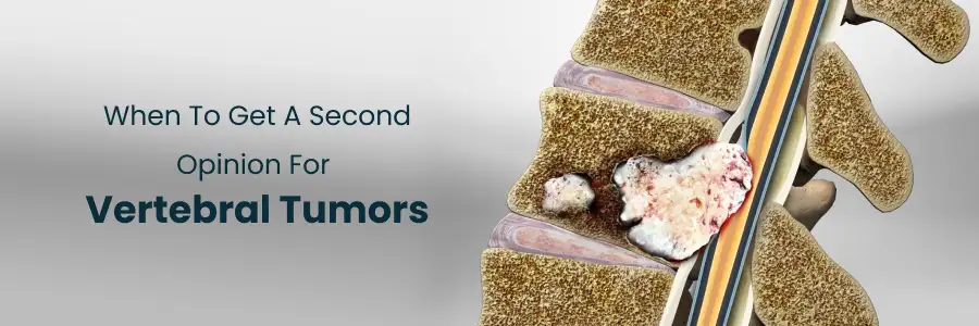 When To Get Second Opinion Vertebral Tumours