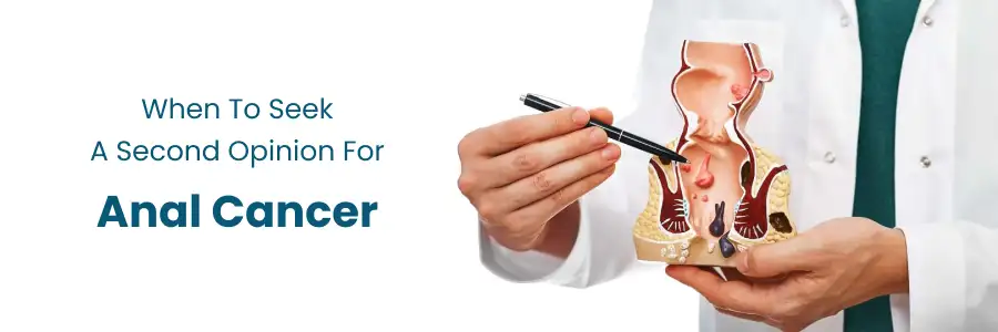 Second Opinion for Anal Cancer