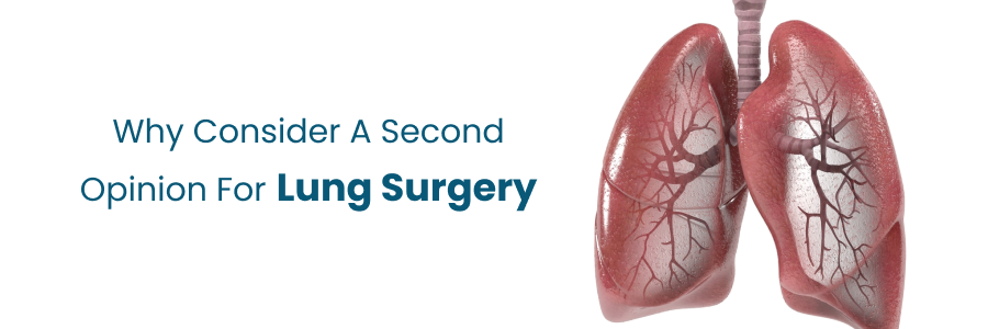 Reasons to consider second opinion in lung surgery