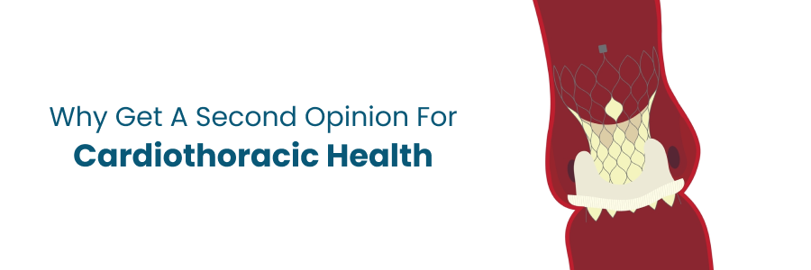 Why Get a Second Opinion in Cardiothoracic Health