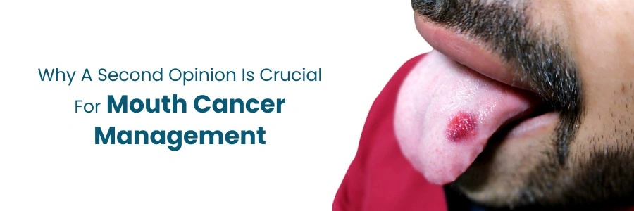 Crucial Role of a second opinion in mouth cancer