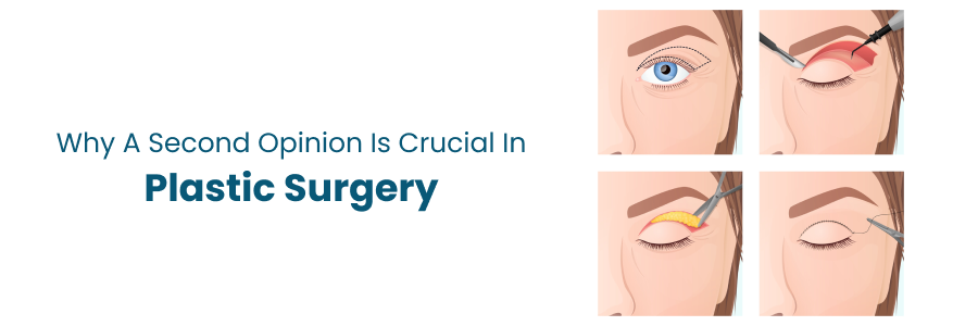 Crucial role of second opinions in Plastic Surgery