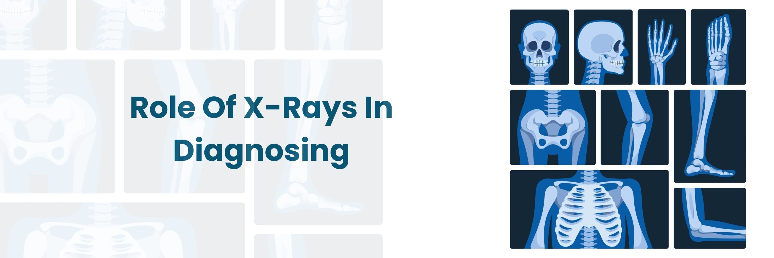 Role of X-rays in Diagnosing and Monitoring Health Conditions