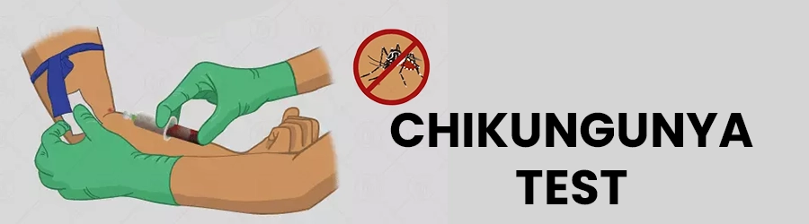 Chikungunya Test