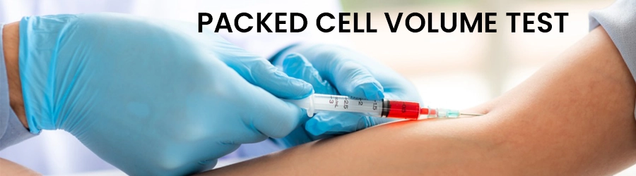 Packed Cell Volume Test