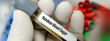 random blood sugar test