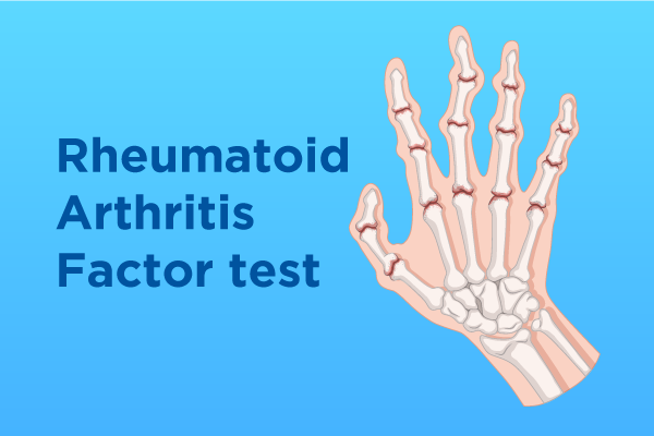 rheumatoid-arthritis-factor-test