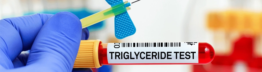 Triglycerides test