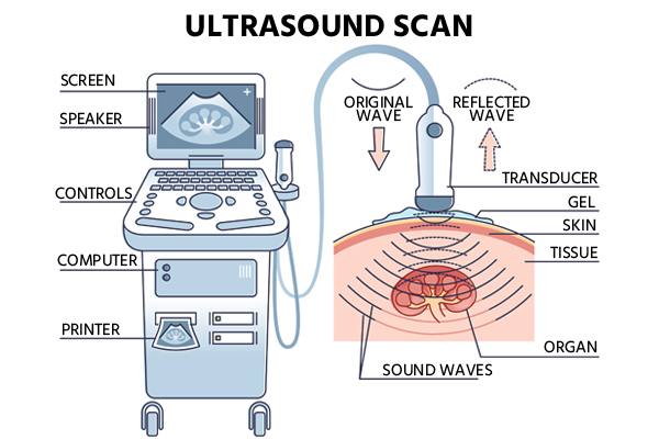 usg or ultrasound.