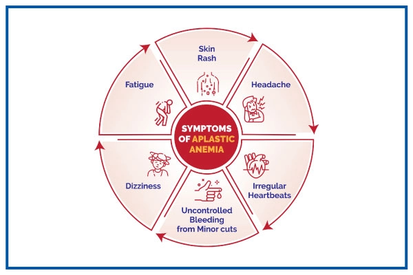 Symptoms of Aplastic Aanaemia