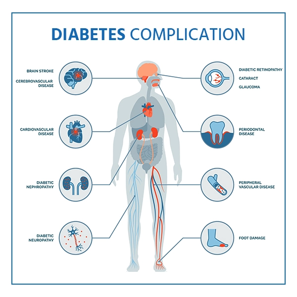 Diabetes Complication