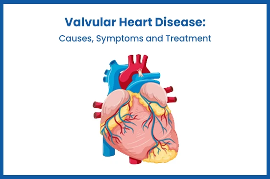 वाल्वुलर हृदयरोग: कारणे, लक्षणे आणि उपचार