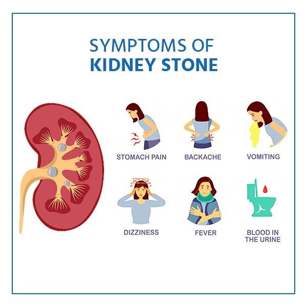 Kidney stones symptoms