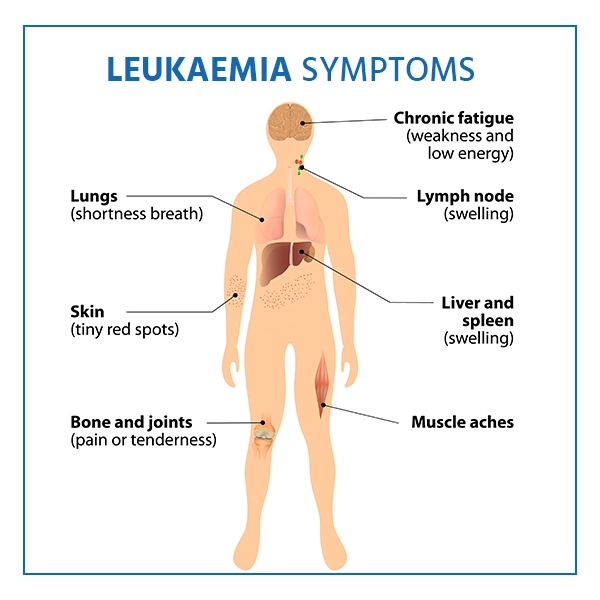 leukaemia symptoms