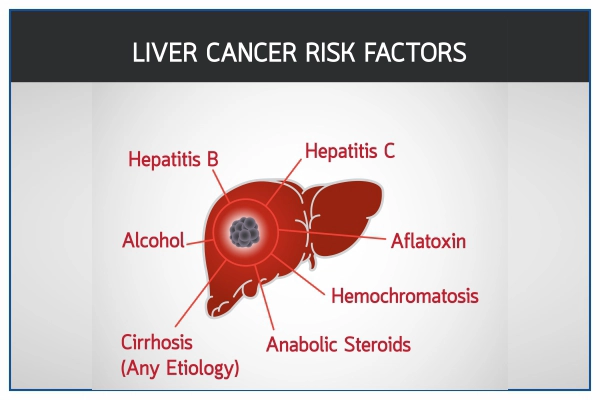 liver-cancer-causes-risk-factors