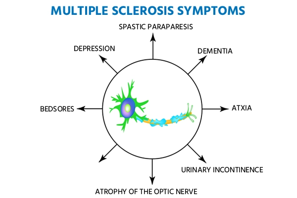 Symptoms of Multiple Sclerosis