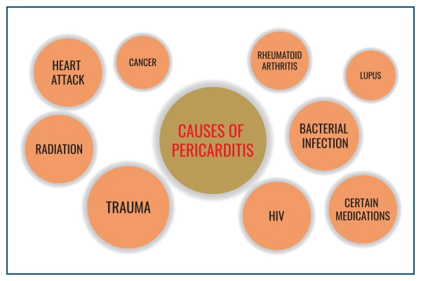 Pericarditis Causes
