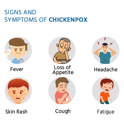 chicken-pox