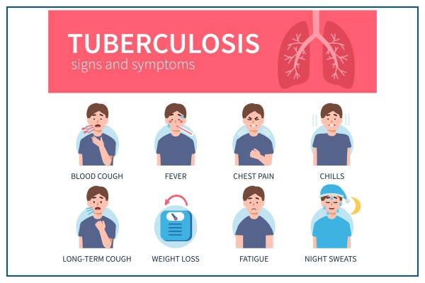 Sign and Symptoms of Tuberculosis
