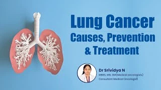 Lung Cancer: Causes, Prevention & Treatment | Medicover Hospitals