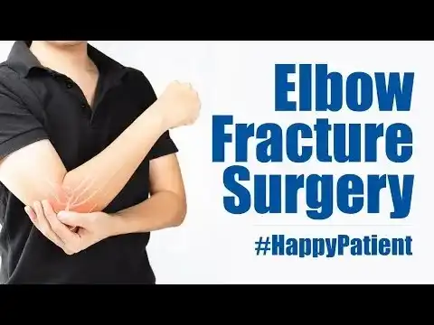 Elbow Fracture Surgery in Kakinada | Medicover Hospitals