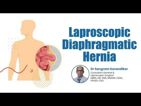 Diaphragmatic Hernia Treatment Success Story | Medicover Hospitals Navi Mumbai