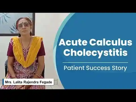 Acute Calculus Cholecystitis Treatment Success Story | Medicover Nashik