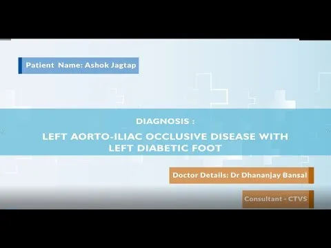 Diabetic Foot & Left Aortoiliac Occlusive Disease Treatment | Medicover Pune
