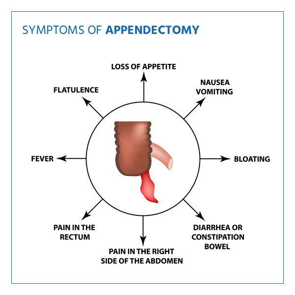 appendectomy symptoms