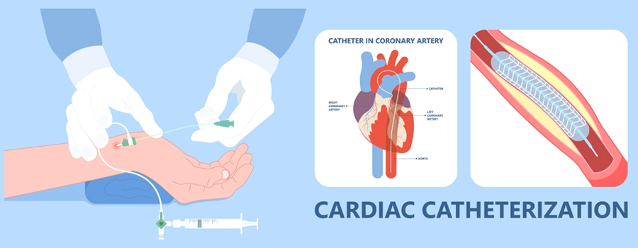 cardiac catheterization