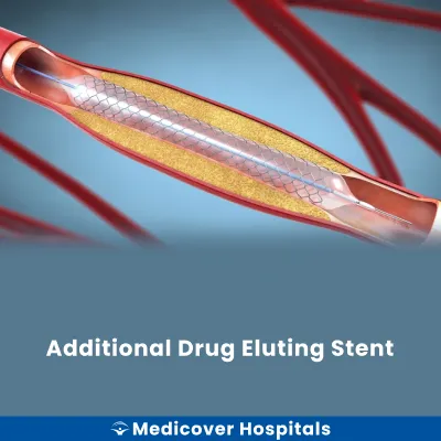 Additional Drug Eluting Stent