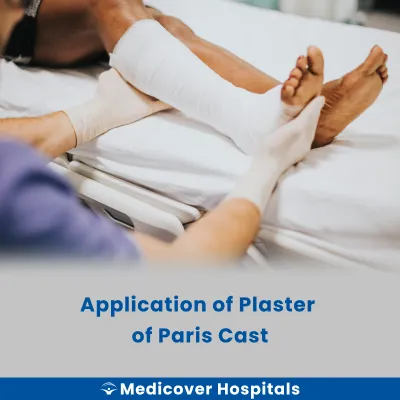 Application of Plaster of Paris Cast