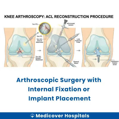 Arthroscopic Surgery With Internal Fixation Or Implant Placement