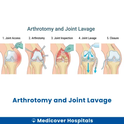 Arthrotomy and Joint Lavage