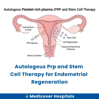 Autologous Prp and Stem Cell Therapy for Endometrial Regeneration
