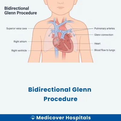 Bidirectional Glenn Procedure