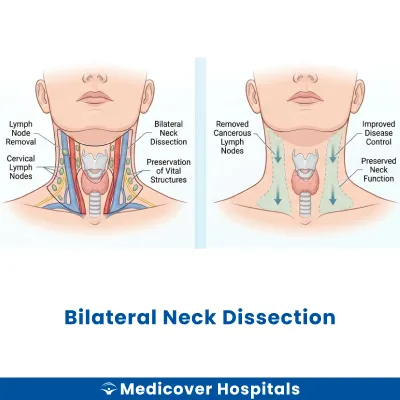Bilateral Neck Dissection