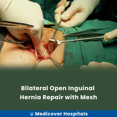 Bilateral Open Inguinal Hernia Repair With Mesh