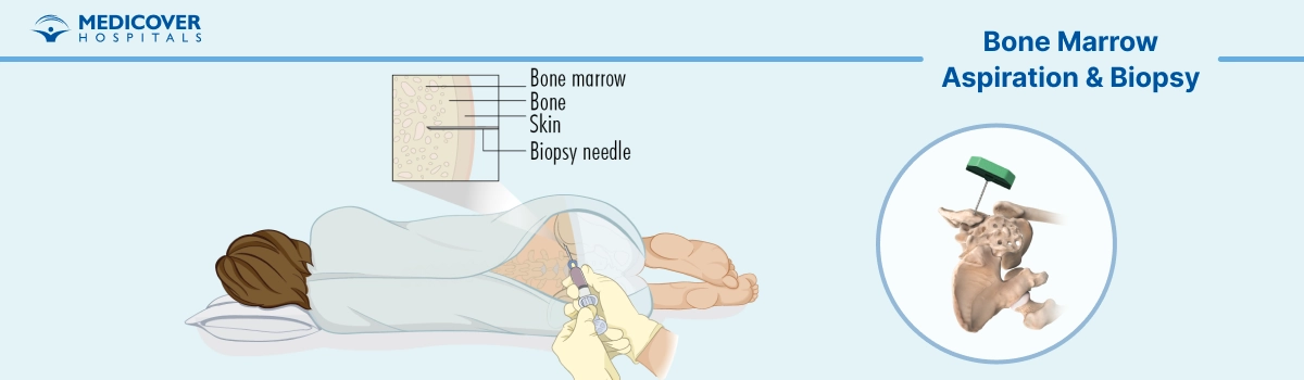 Bone Marrow Aspiration & Biopsy