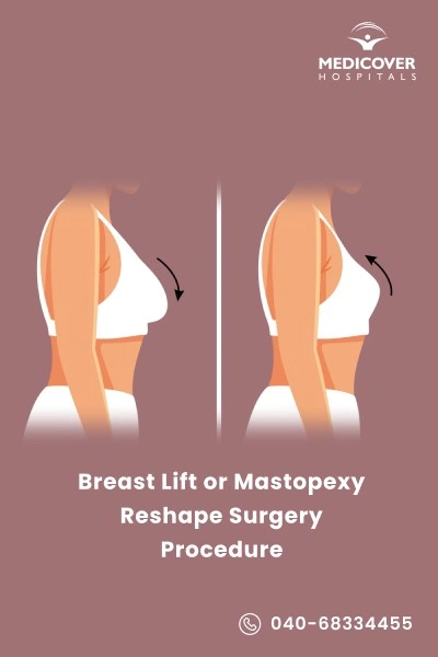 breast-lift-surgery