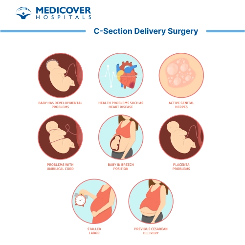 C section delivery Surgery