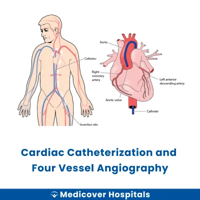 Cardiac Catheterization and Four Vessel Angiography