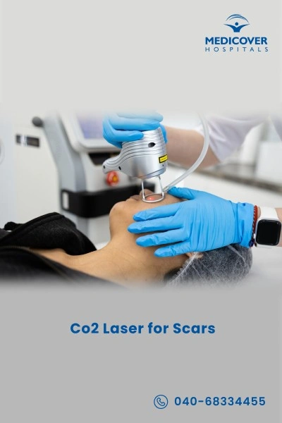 co2-laser-for-scars