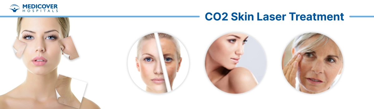 CO2 laser for scars