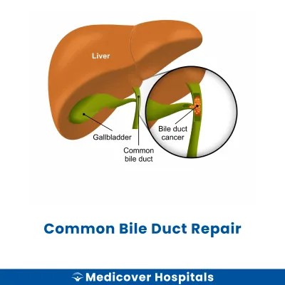 Common Bile Duct Repair